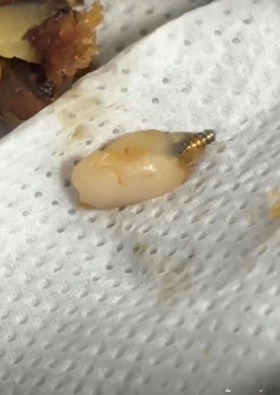 山姆客服回应枣泥核桃蛋糕吃出牙这到底是松子还是牙？底部的螺丝看起来好像种植牙那这