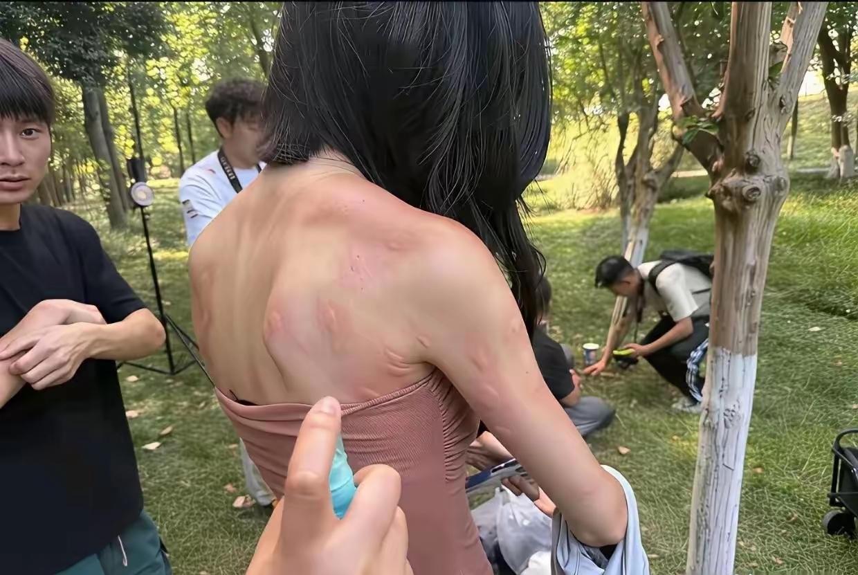 这些蚊子太欺负人了，逮住一个吃吗这是。