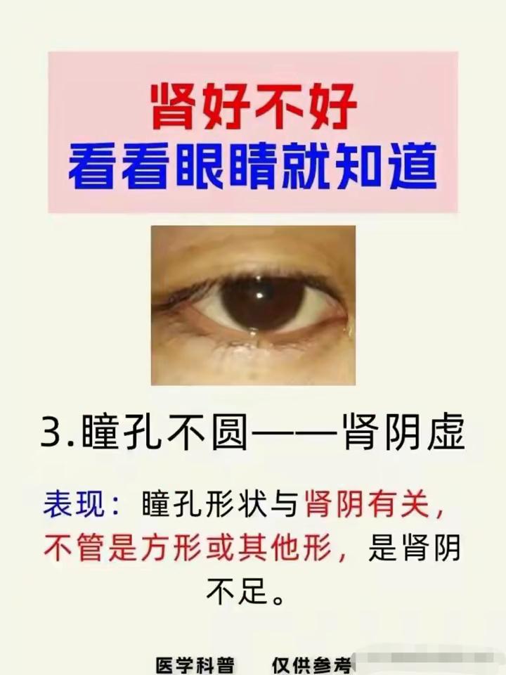肾好不好看看眼睛就知道。·1.眼神猥琐-长期肾亏。表现：肾虚的人眼睛多带邪气、