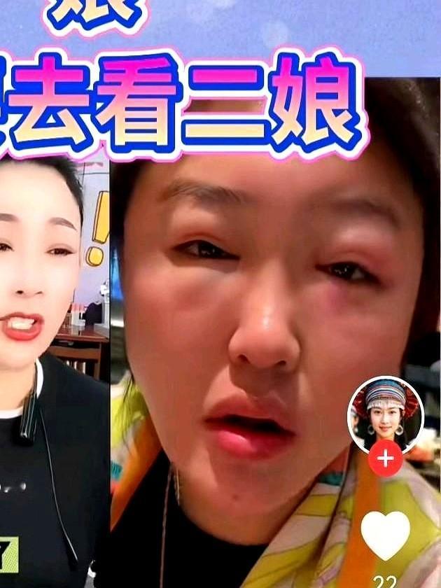 离开赵本山，曾被认为前途黯淡的娇娇，如今却活成了很多人意外的样子。2022年