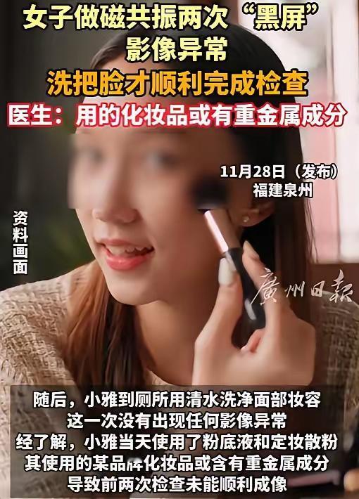 解释不清了！福建一29岁女生头晕，去医院做头颅磁共振。不料，连续2次扫描，都因