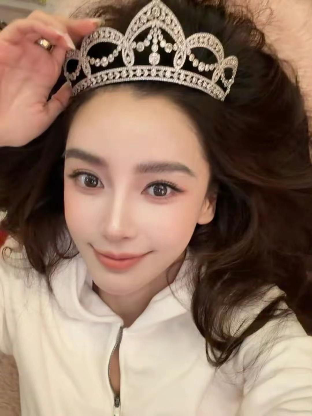 好美的纯生live图啊啊啊angelababy杨颖