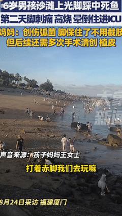 长见识了！福建厦门，6岁男孩在沙滩上光脚玩耍后莫名高烧呕吐，母亲以为是中暑，结果