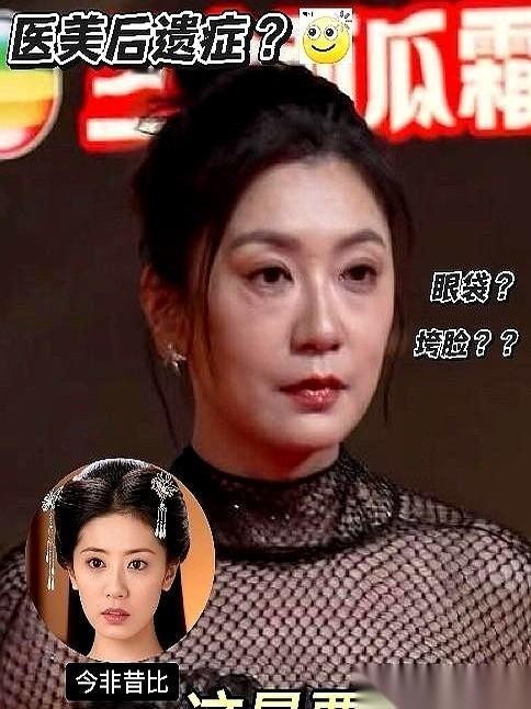 一堆人冲上去说贾静雯脸崩了。我看了半天，这哪里是崩了？这分明是勋章啊。一张