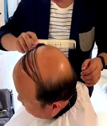 男人掉头发，其实分三种“判决”。两种有救，一种，是绝症。最要命的，就是写在基