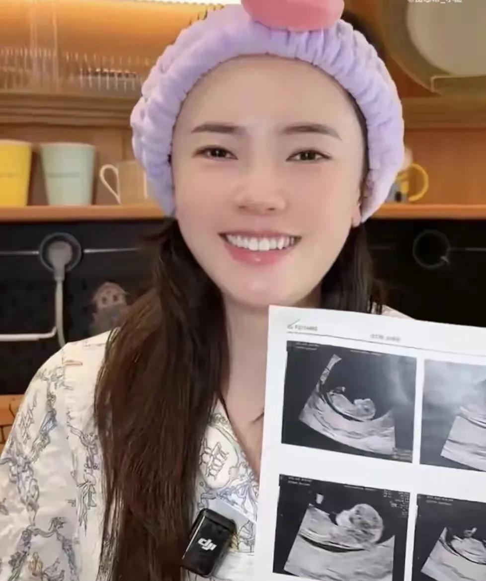 八卦田志希一个好消息！田志希怀孕了。一退役就怀孕生子，当下可不多见。祝福田志希