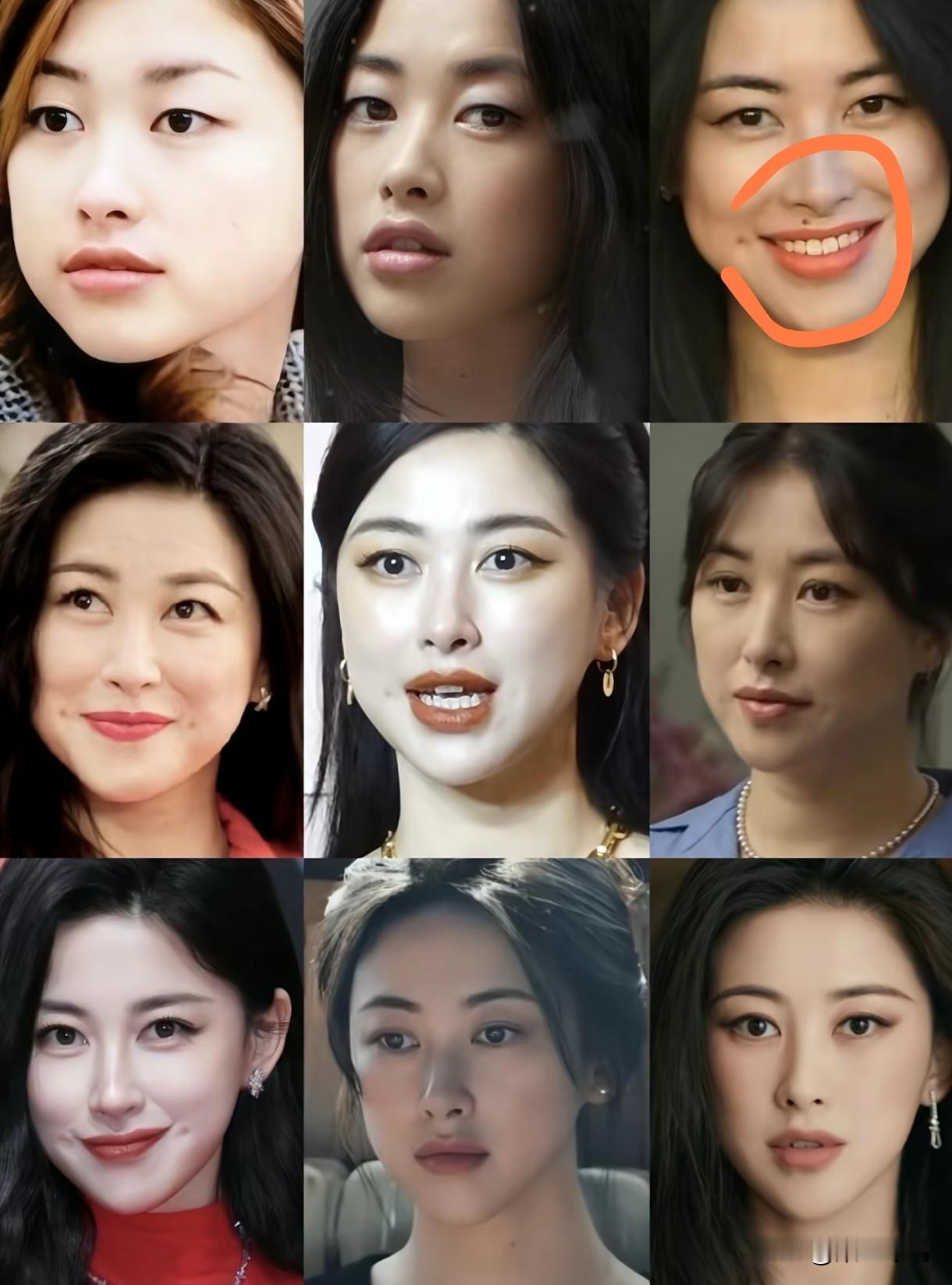 真的不用担心，朱珠的“富贵痣”点掉了，结果并不是大家想的那样，我也有一个亲