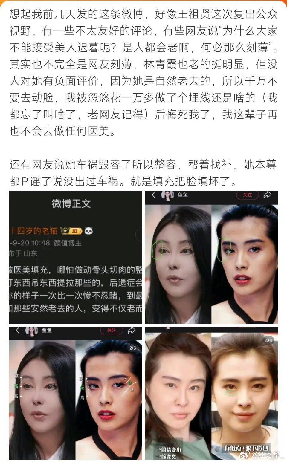 不求满满的胶原蛋白，但是也别满满的玻尿酸呀！王祖贤称60岁还被议论容貌王祖贤复
