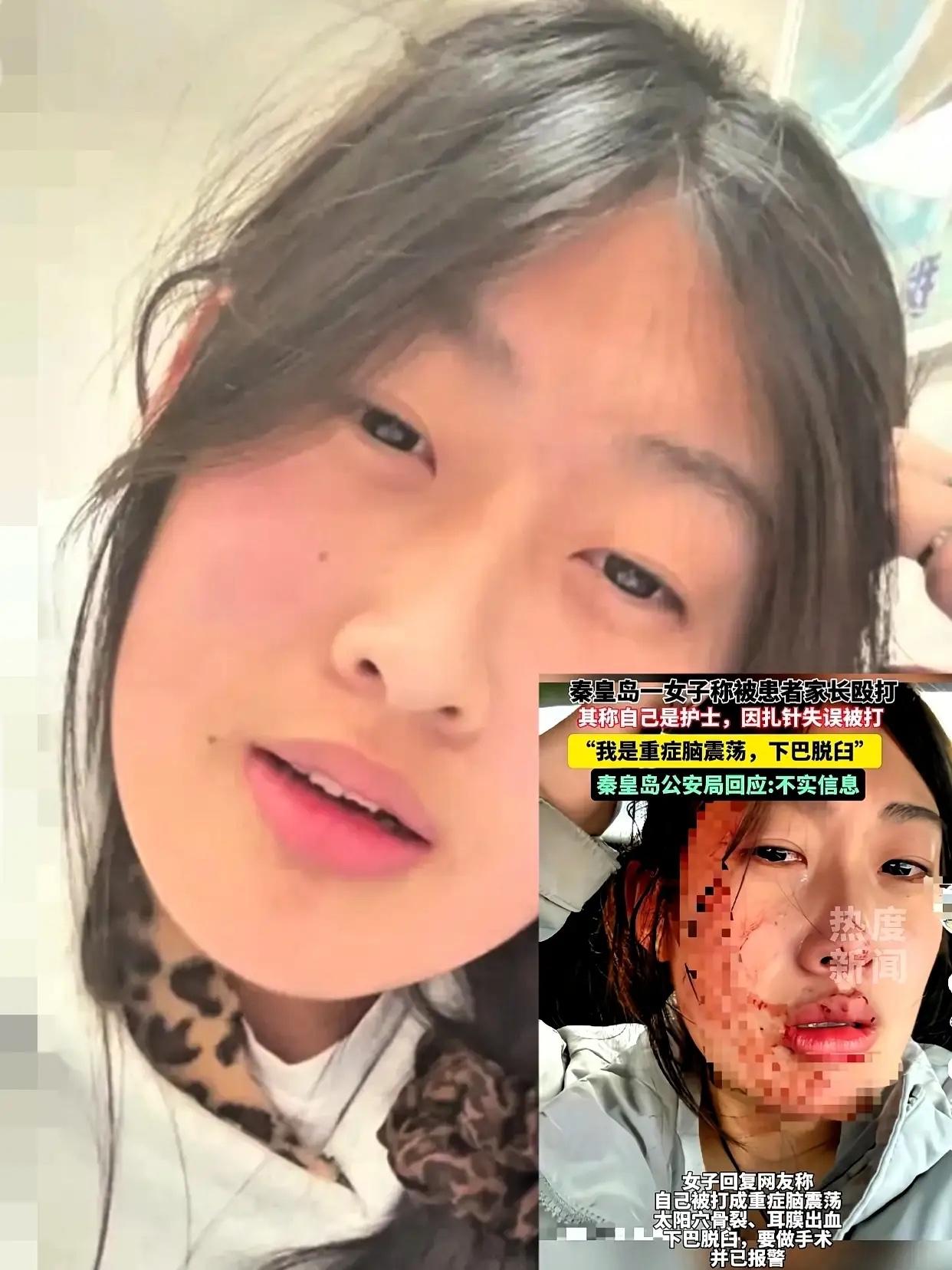 万万没想到啊！[惊恐][惊恐][惊恐]护士被打事件居然反转了！秦皇岛市第一医院