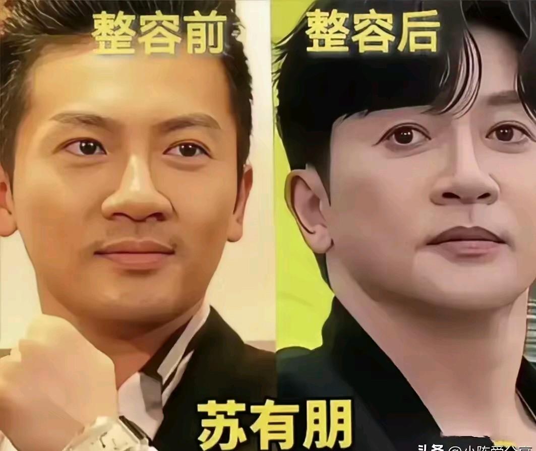苏有朋这不是整容而是毁容呀，看看苏有朋整容前和整容后的颜值对比，这那是整容，这明