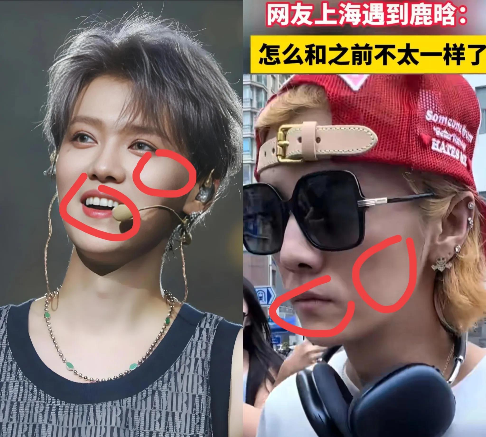 鹿晗，真的分手了吗？状态真的太令人心疼了！面部凹陷，嘴角