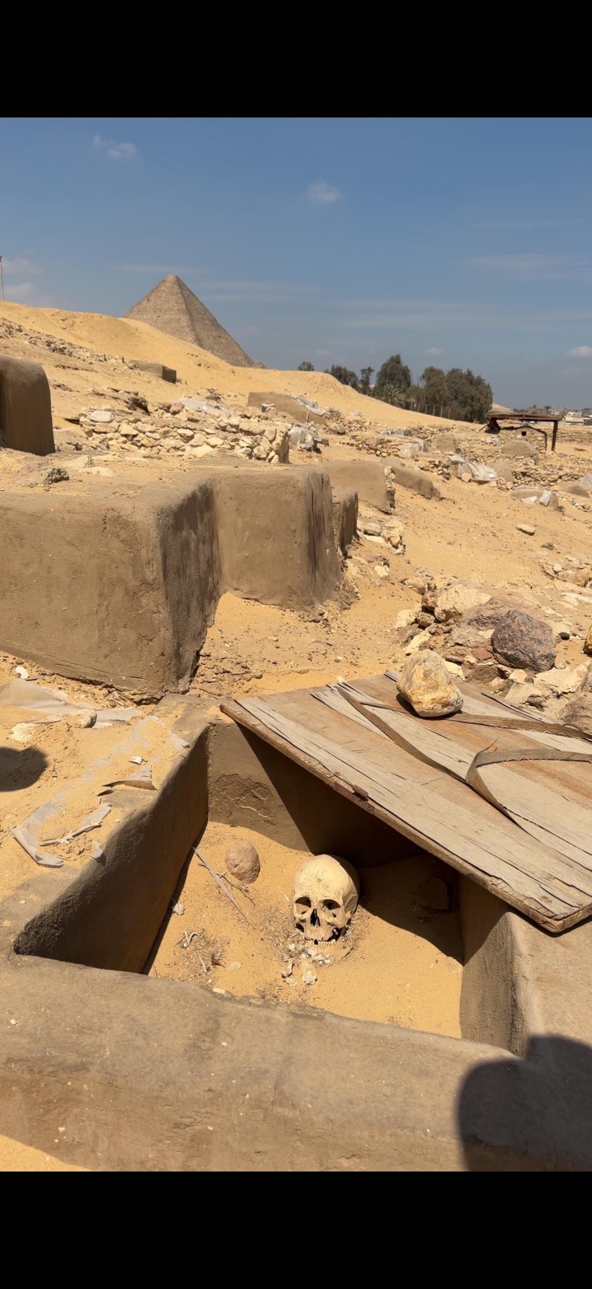 埃及吉萨高原上展示的这个头骨，据称属于古代工人，但更可能是20世纪20年代挖掘出