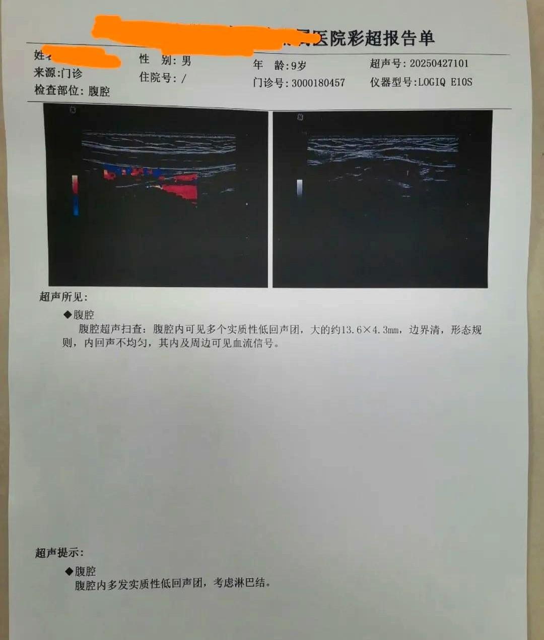 孩子肚子疼孩子时不时肚子疼，终于找到原因了前段时间孩子早上起来总是肚子疼，经