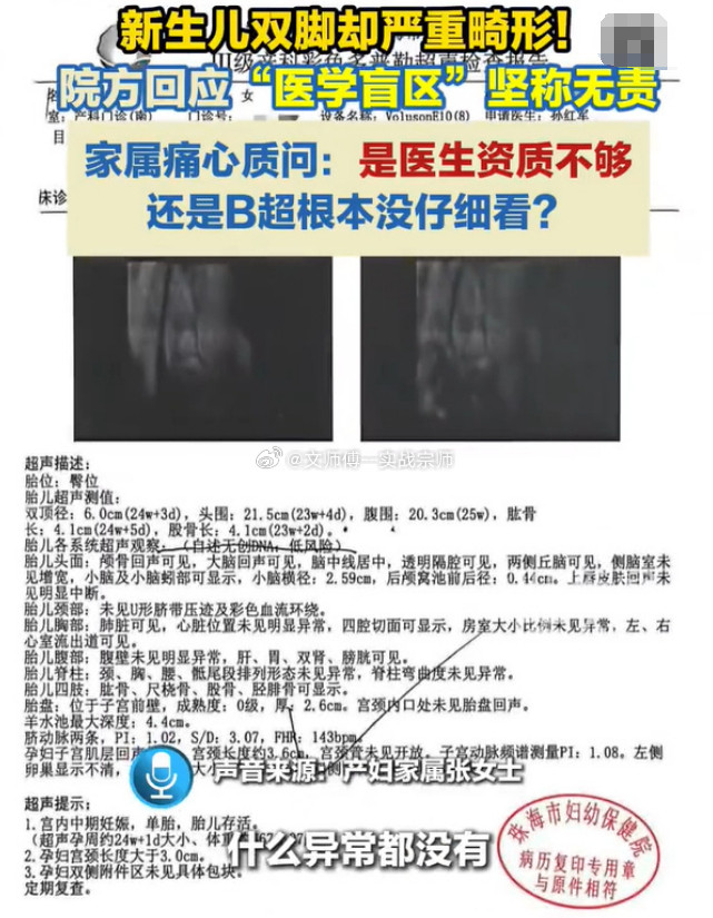 家属回应幼儿产检正常出生双脚畸形近日，广东珠海发生一起新生儿产检漏诊事件，引发