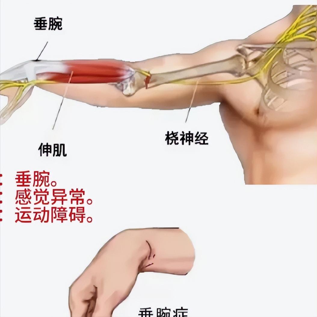神经损伤后的疼痛，真要跟一辈子？我来告诉你答案很多神经损伤的朋友，最怕的不是