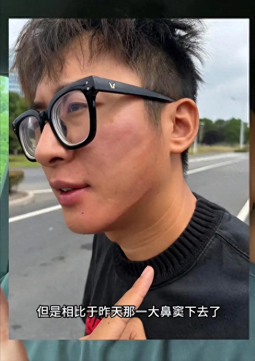 太离谱了！江苏街头发生荒唐一幕，正常的小车追尾事故，本来走保险就能解决，谁料后车
