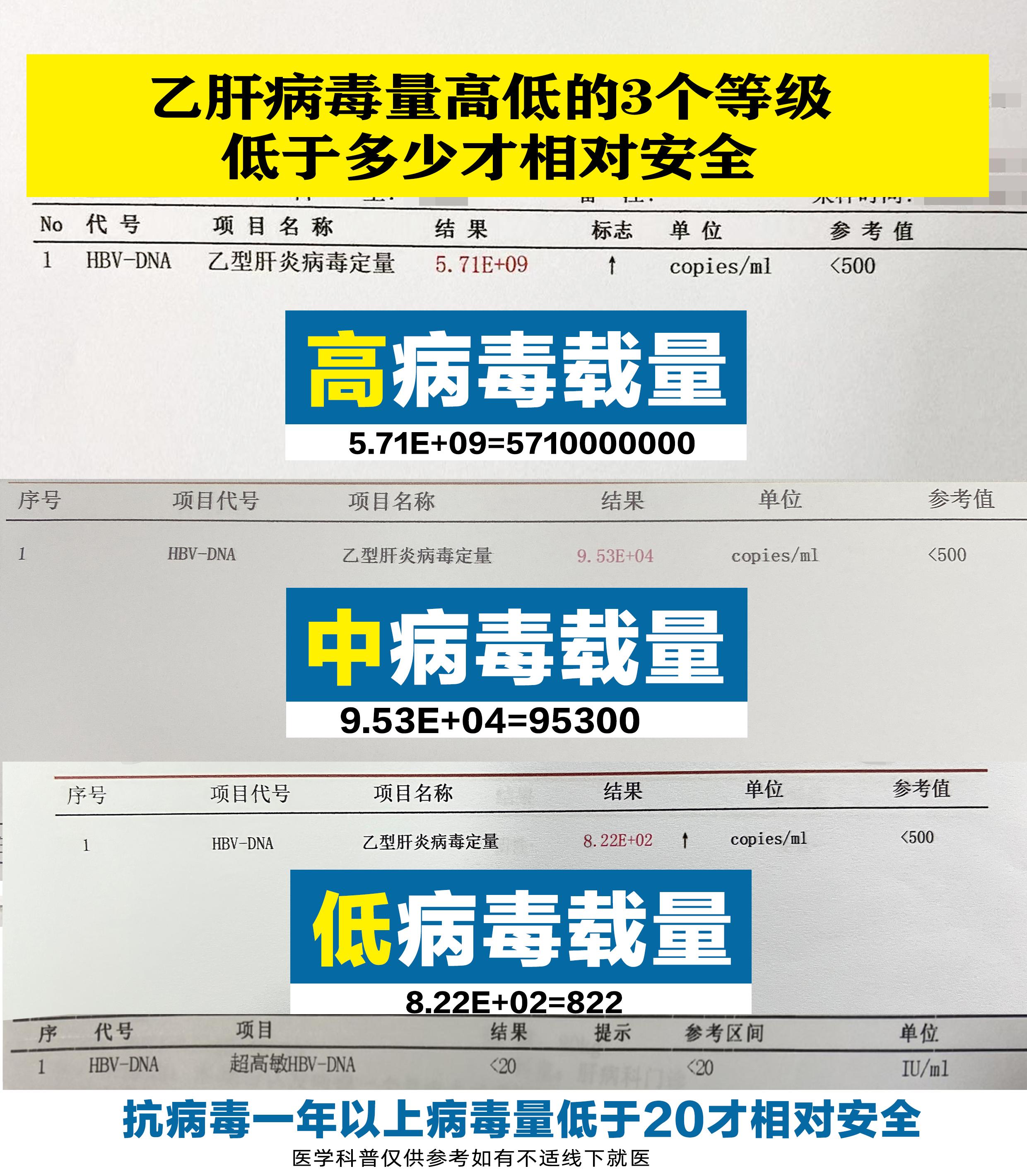 乙肝病毒量高低的3个等级，低于多少才相对安全