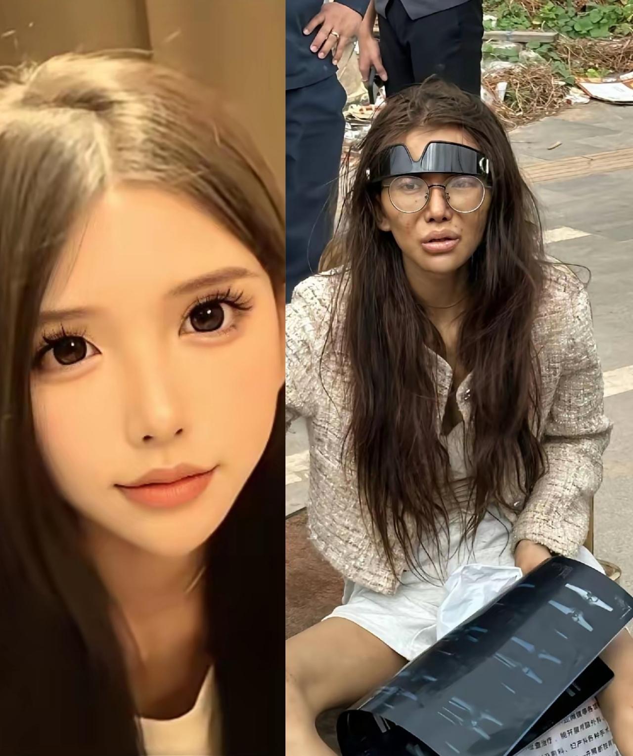 福建一女网红去东南亚某国淘金，最后变成了照片中的模样，真是令人唏嘘和惋惜！这