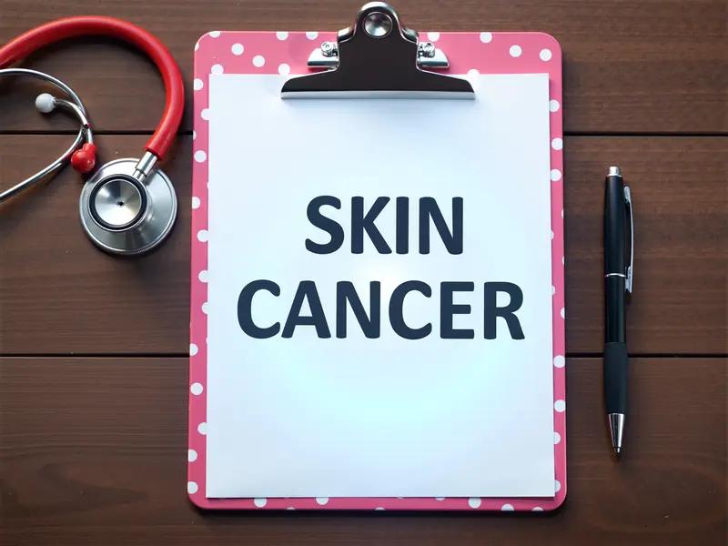 想早期发现皮肤鳞状细胞癌，得留意皮肤变化。这病好发于五六十岁的人，面颈部、手部等