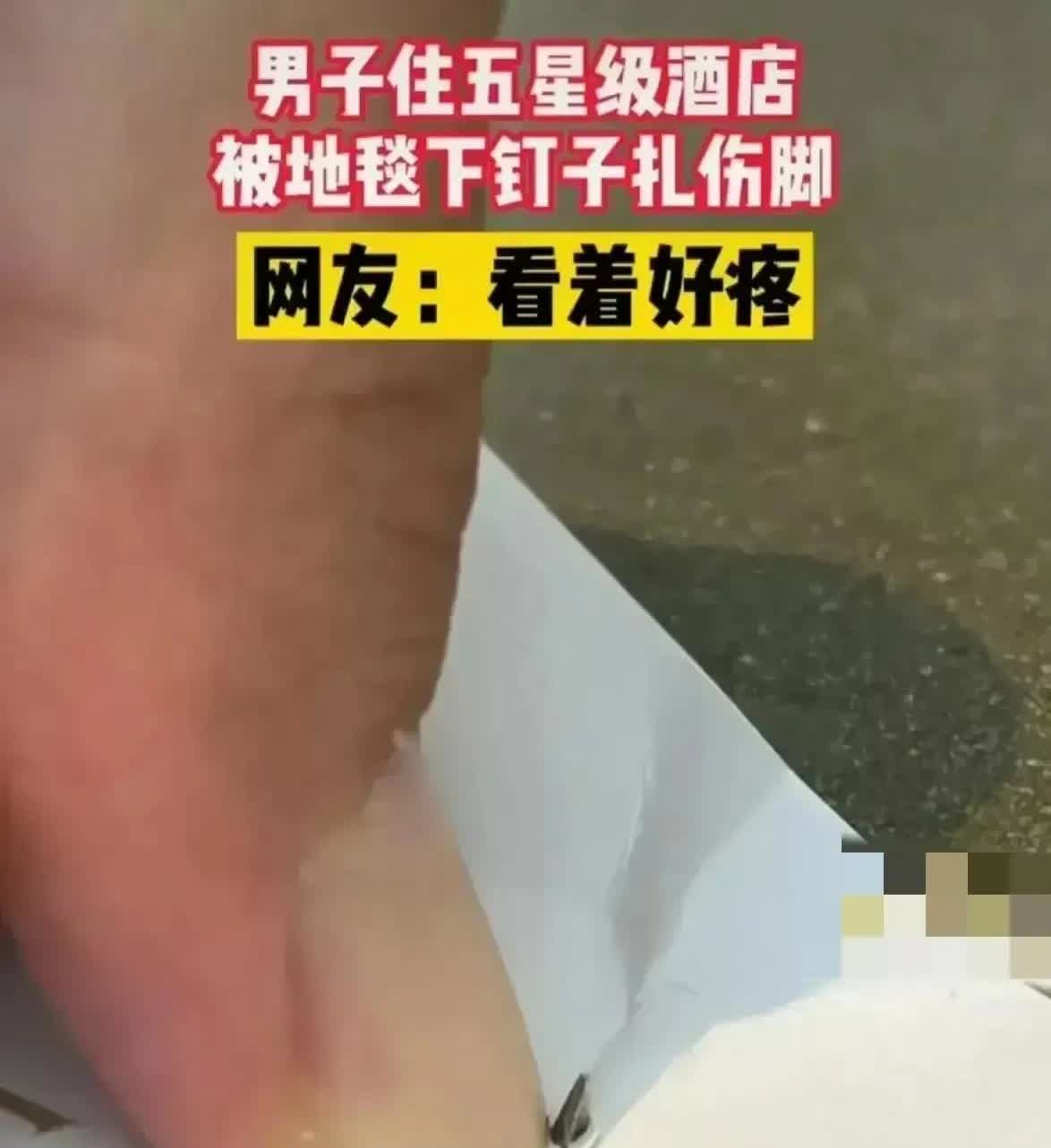 辽宁沈阳，一男子入住高档酒店，光着脚丫在毛毯上走动，脚掌刺痛传来，紧接着坐在了地