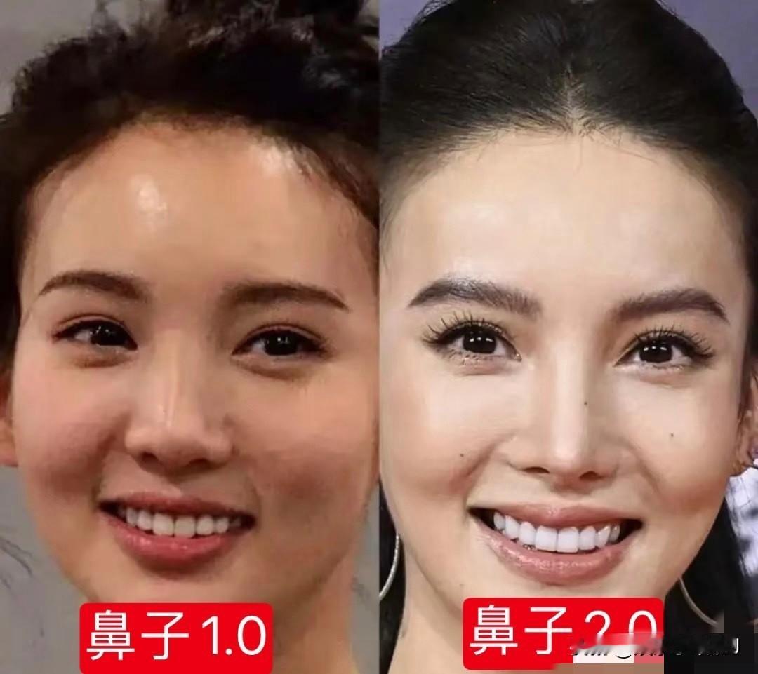 医美金晨以前不长这样！不要过度医美啊？哎！​​​这已经不是医美了，整容加上太瘦