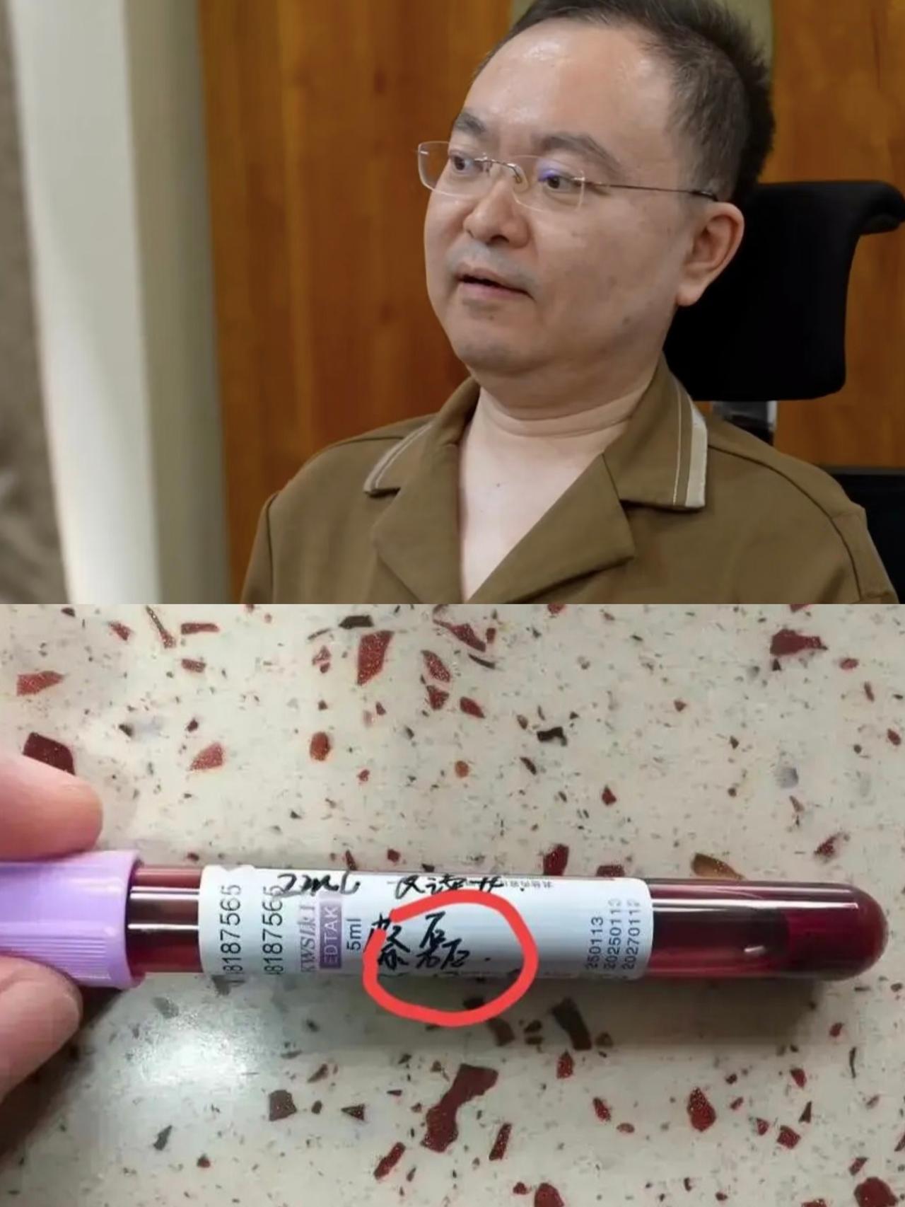 蔡磊靠眼动仪推进渐冻症药却救不了自己，现在全身上下就剩眼球能动了，哪怕这样，