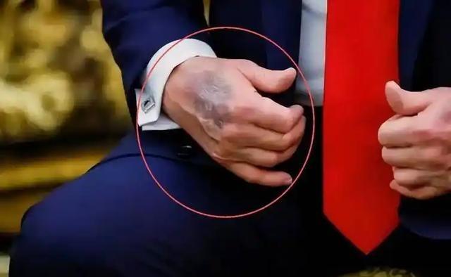 不管特朗普去世的消息是真是假，但可以肯定，他的健康状况已经出了大问题。2025