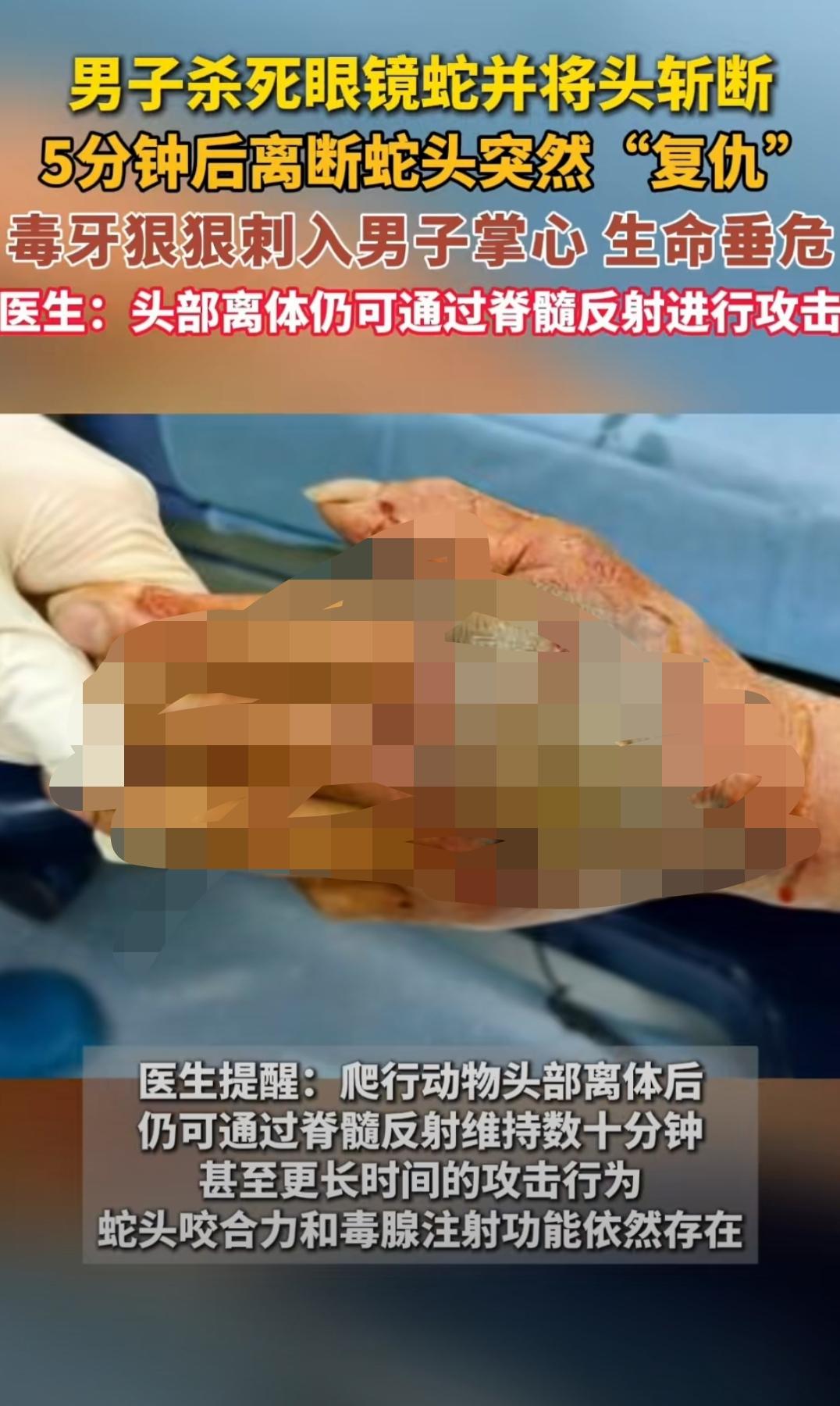 “不作死就不会死！”浙江，男子杀死眼镜蛇并将蛇头斩断，他听人说蛇头就算掉了也会咬