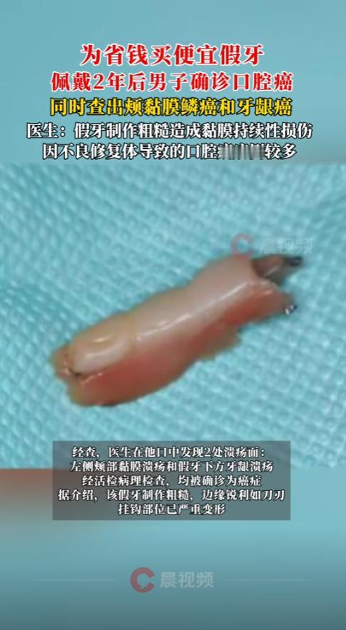 一副假牙的代价“这下后悔了吧！”湖南长沙，一男子为了省钱，买了一副劣质的假牙老