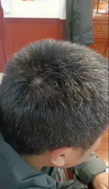 为什么白发？真不一定是“命里带的”现在白发好像不算稀奇了，有人染黑，有人干脆染