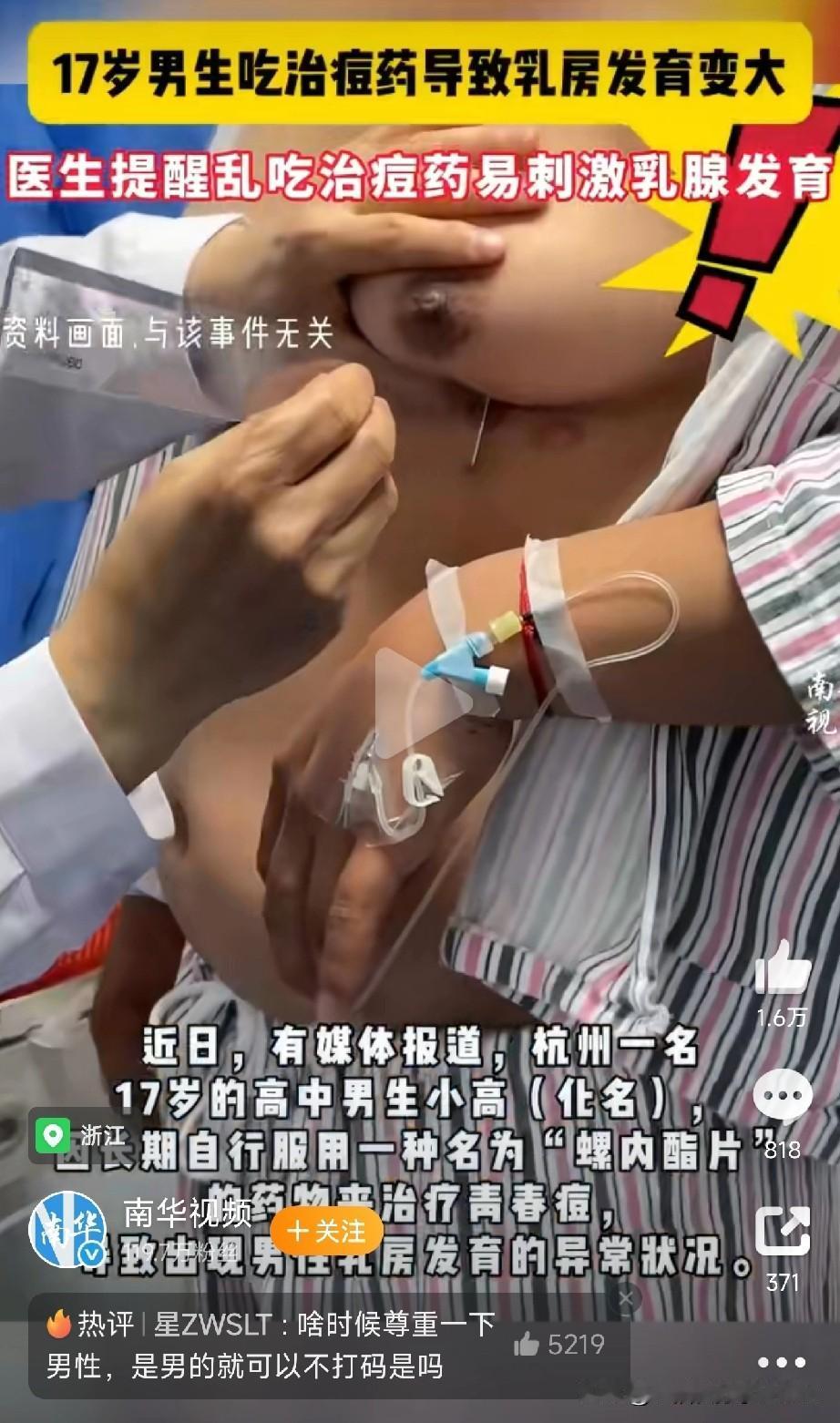 药别乱买乱吃！最近杭州一位17岁的高中男生小高一直受青春痘困扰，之前在医生那