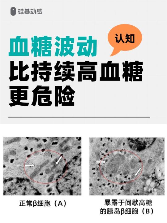 「认知篇」大幅度的血糖波动会导致什么？