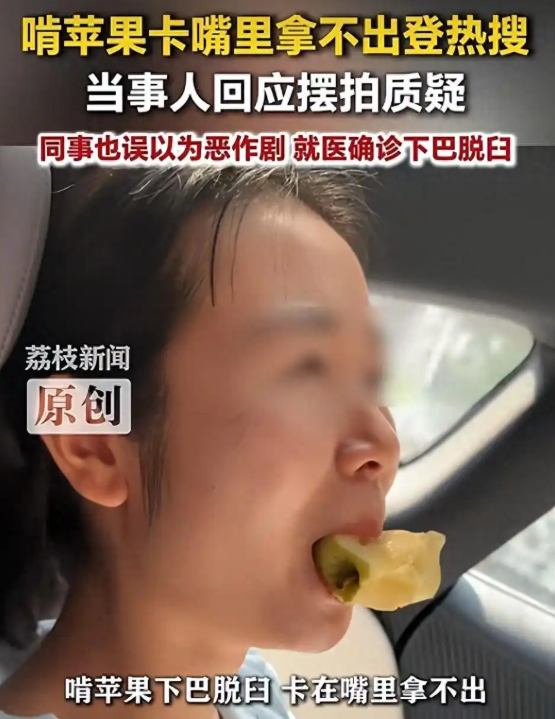 见过吃苹果进医院的，没见过叼着半块苹果去医院的！浙江杭州，一女子在家啃苹果。眼瞅着苹果就剩最后一大口