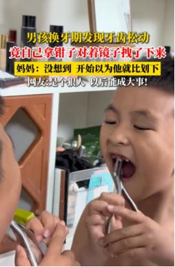 “此子必成大器！”6月9日报道，黑龙江，一个七岁半的男孩正在换牙期，发现自己有颗