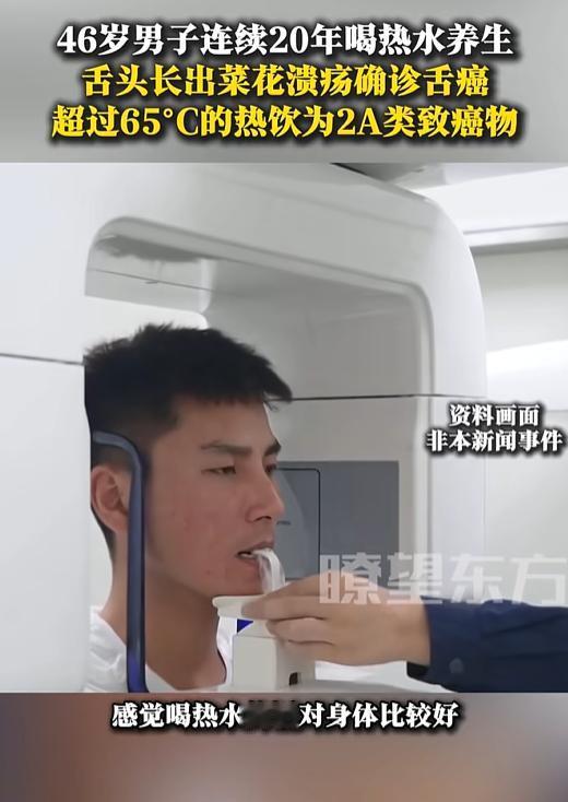 河南一46岁男子为了养生，竟然连续20年喝热水，还冒着白气就往嘴里送，结果导致舌