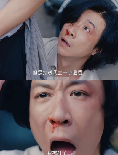 话剧演员的“职业病”，竟成了他演活小人物的绝杀。你看张维伊在《小城大事》里抠着