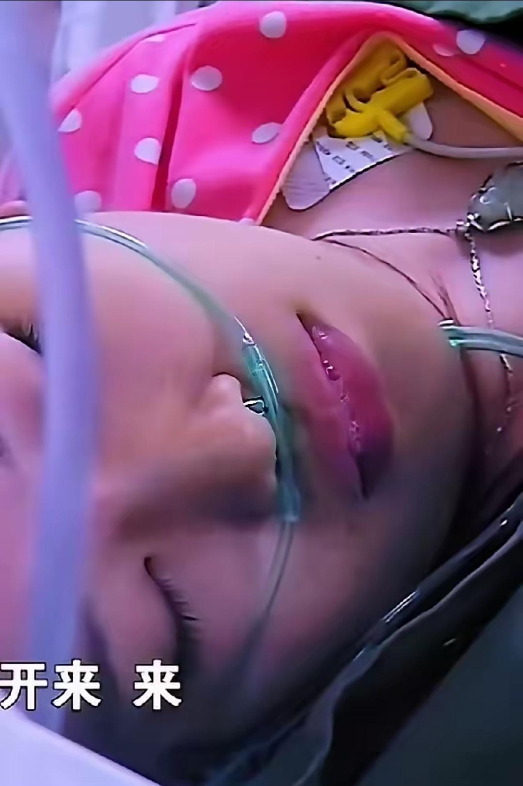 22岁姑娘在洗澡时突然昏迷不醒，恶心呕吐，送到医院检查是脑出血，双侧瞳孔散大，对