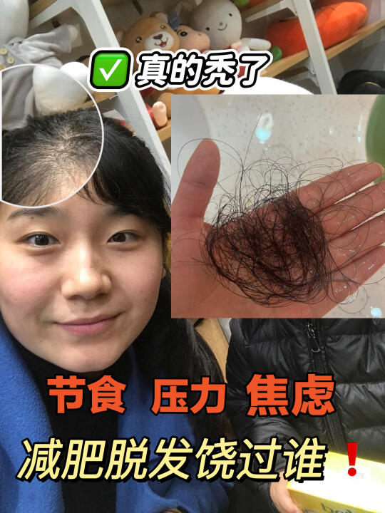 自用一年 发量爆棚㊙️4招让你一年换头