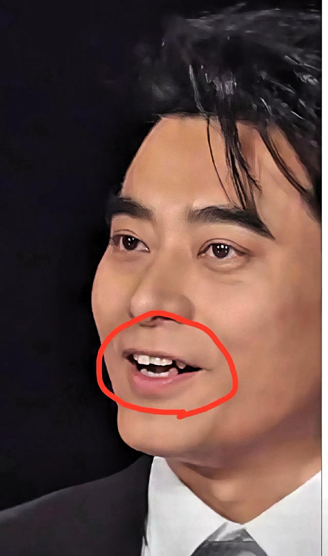 49岁的陈龙给所有人提了个醒，那就是你可以不帅气，也可以身材不好，但是一定要注意