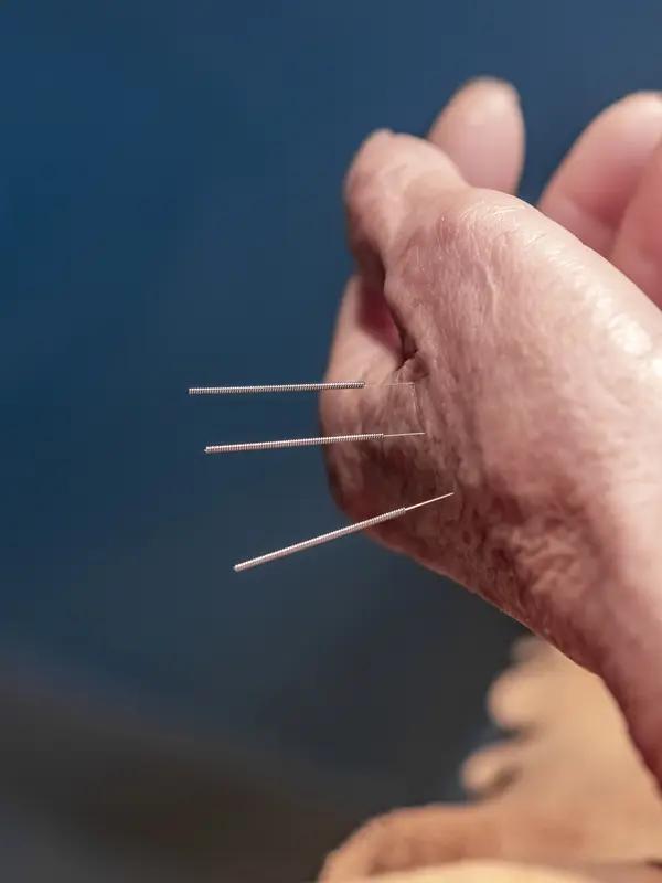 中医又有哪些特色疗法?中医又有哪些特色疗法?中医特色疗法丰富多样、博大精深、源