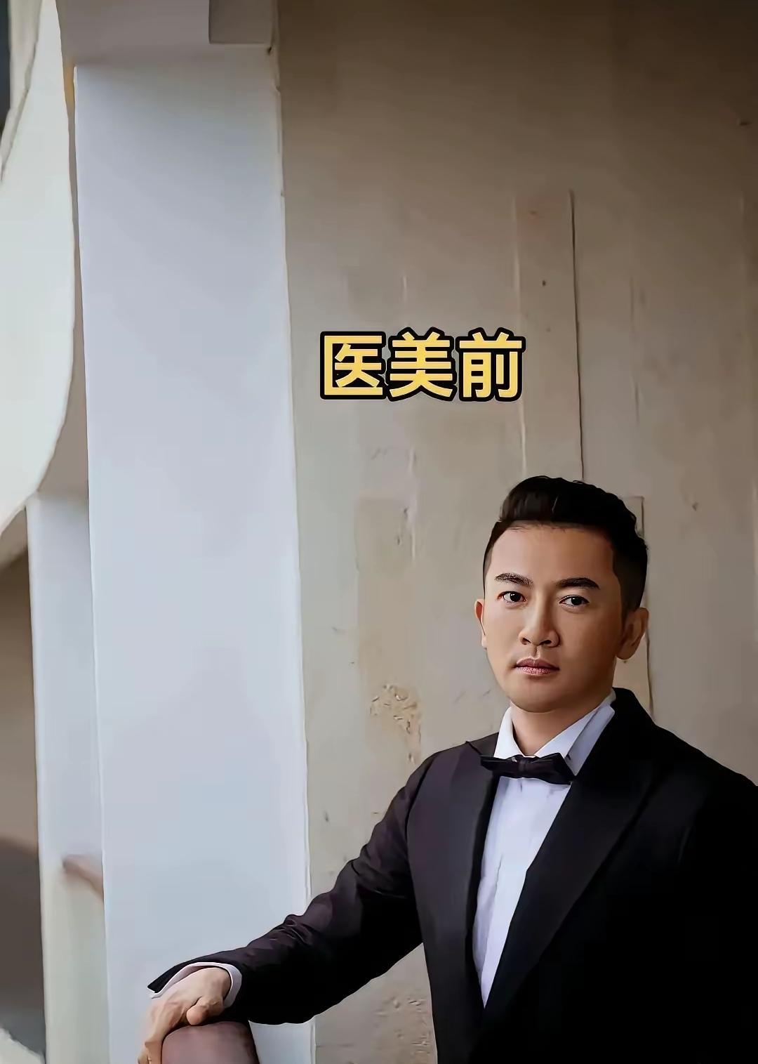 天哪，整容太可怕啦！连明星整容都成了这副模样，你说说咱们普通人还敢整吗？他们