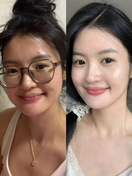 变白是长期主义的事，只有你自己能帮你