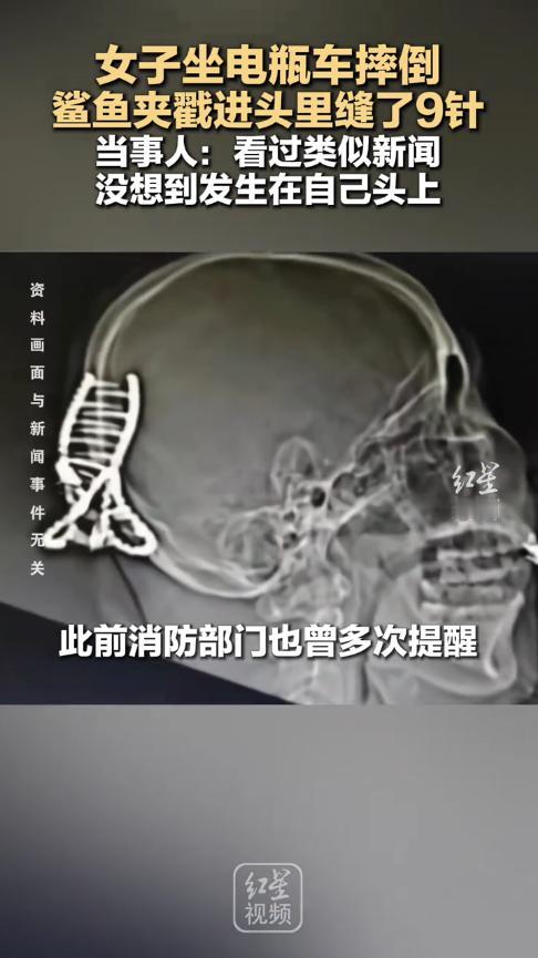 悲剧还是发生了！12月3日，河南信阳，一女生酒后乘坐电瓶车，结果不慎摔倒，导致发