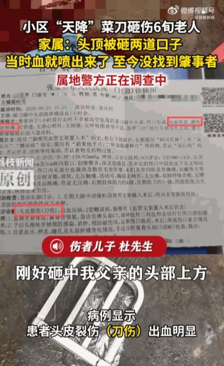 你敢信吗？在自家二楼露台上晒个太阳，头顶居然能飞下来一把菜刀，还正好砸在脑袋上。