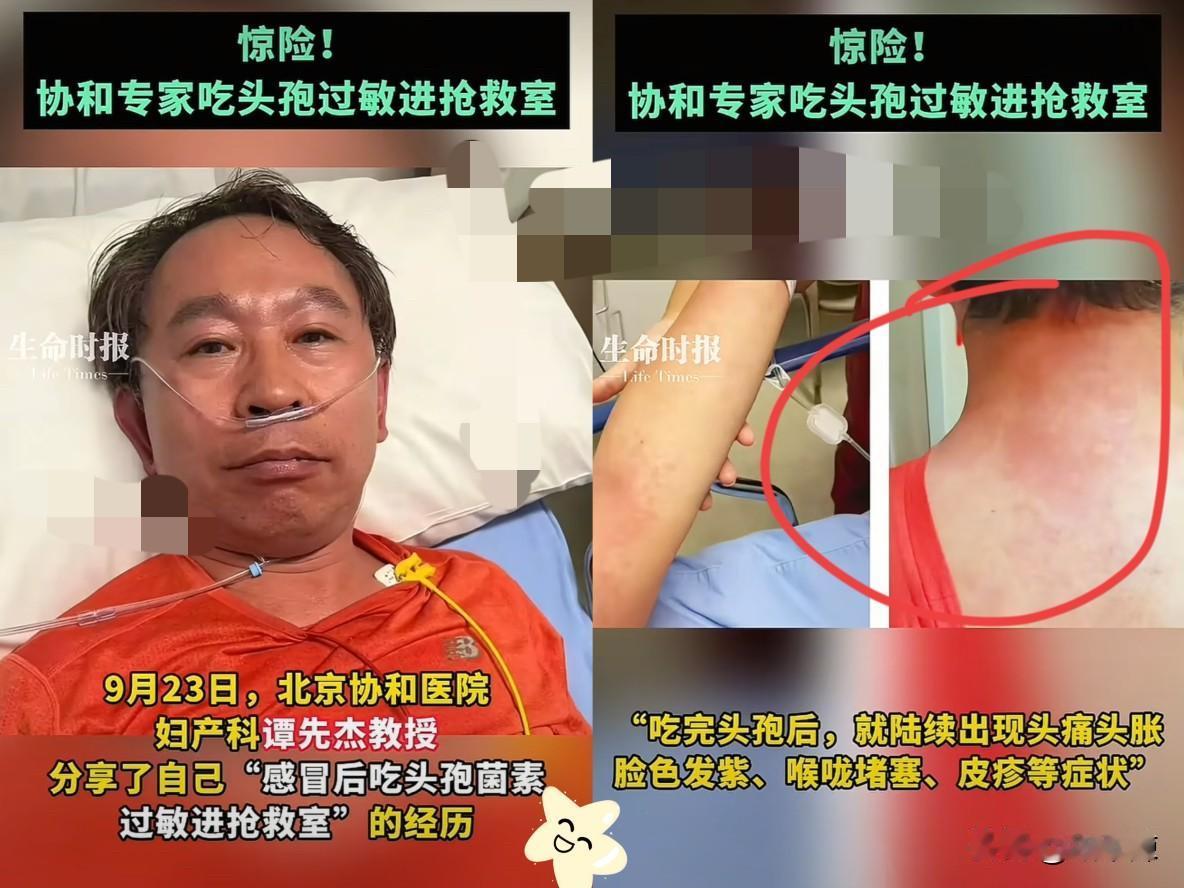 北京，协和医院的谭先杰教授感冒后吃了片头孢，才几分钟就头痛欲裂、胸口发闷，胳膊上