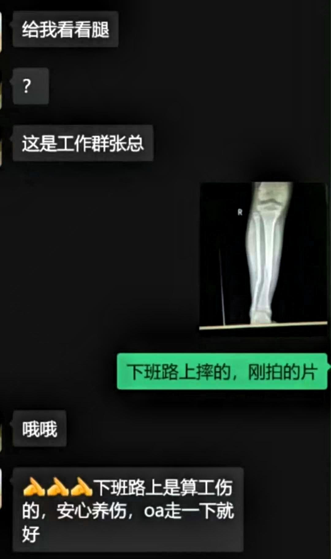 顶级救场，领导调惜女员工，却误发到工作群，场面一时变得微妙。如果无人回应，会