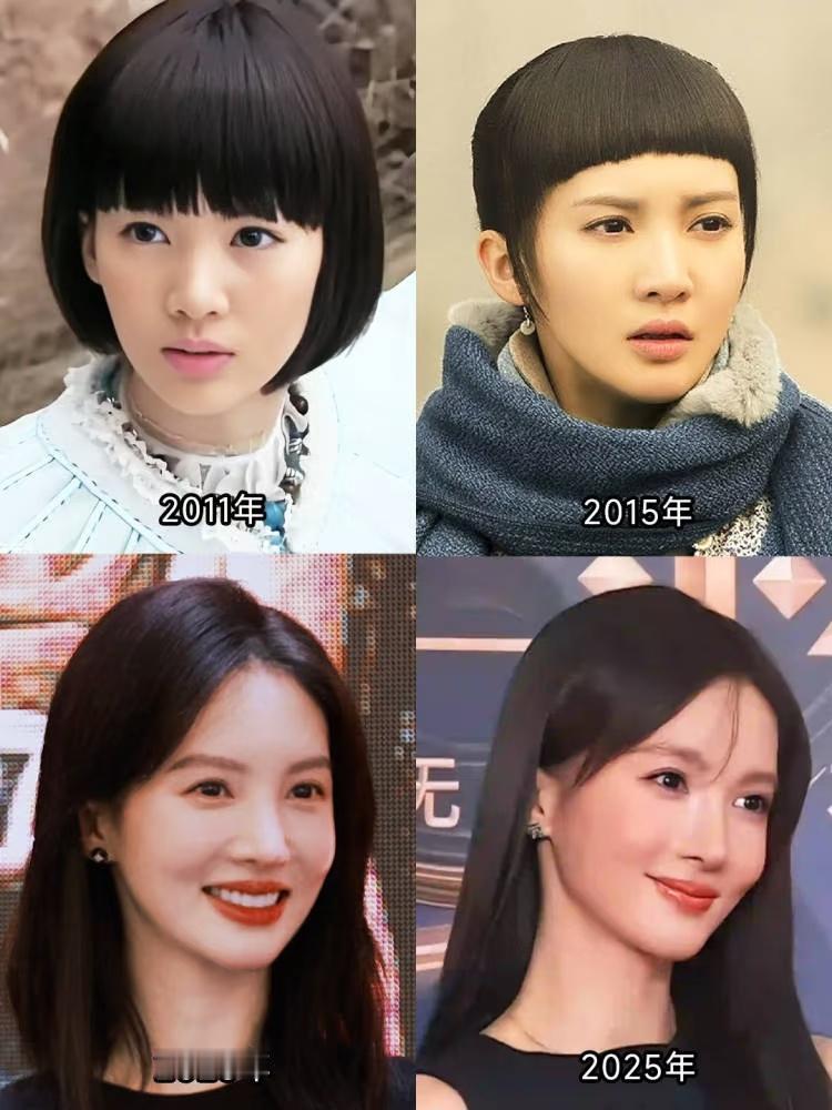 金晨医美：明星维持外表的常见选择，实属正常金晨医美引发诸多讨论，实则这不过是