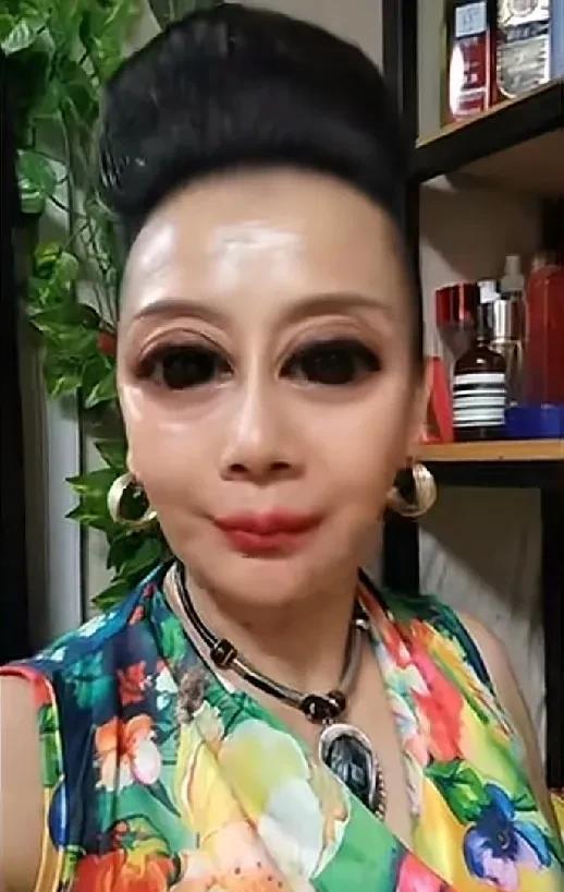 这女子的双眼皮是后天做的。一共花了20000元。效果就这样。你认为值不值？我