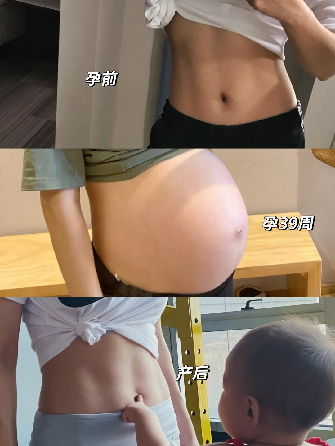 产后恢复