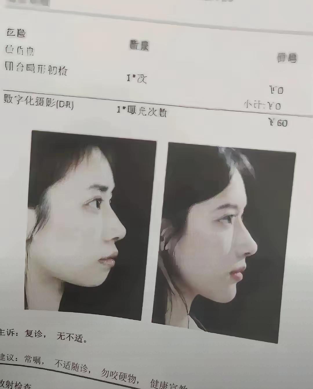 美人在骨不在皮你敢相信这是一个人吗？皮相的问题能靠化妆、护肤救，皮肤黄了涂